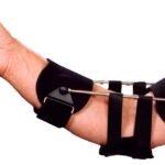 Extensor de Codo